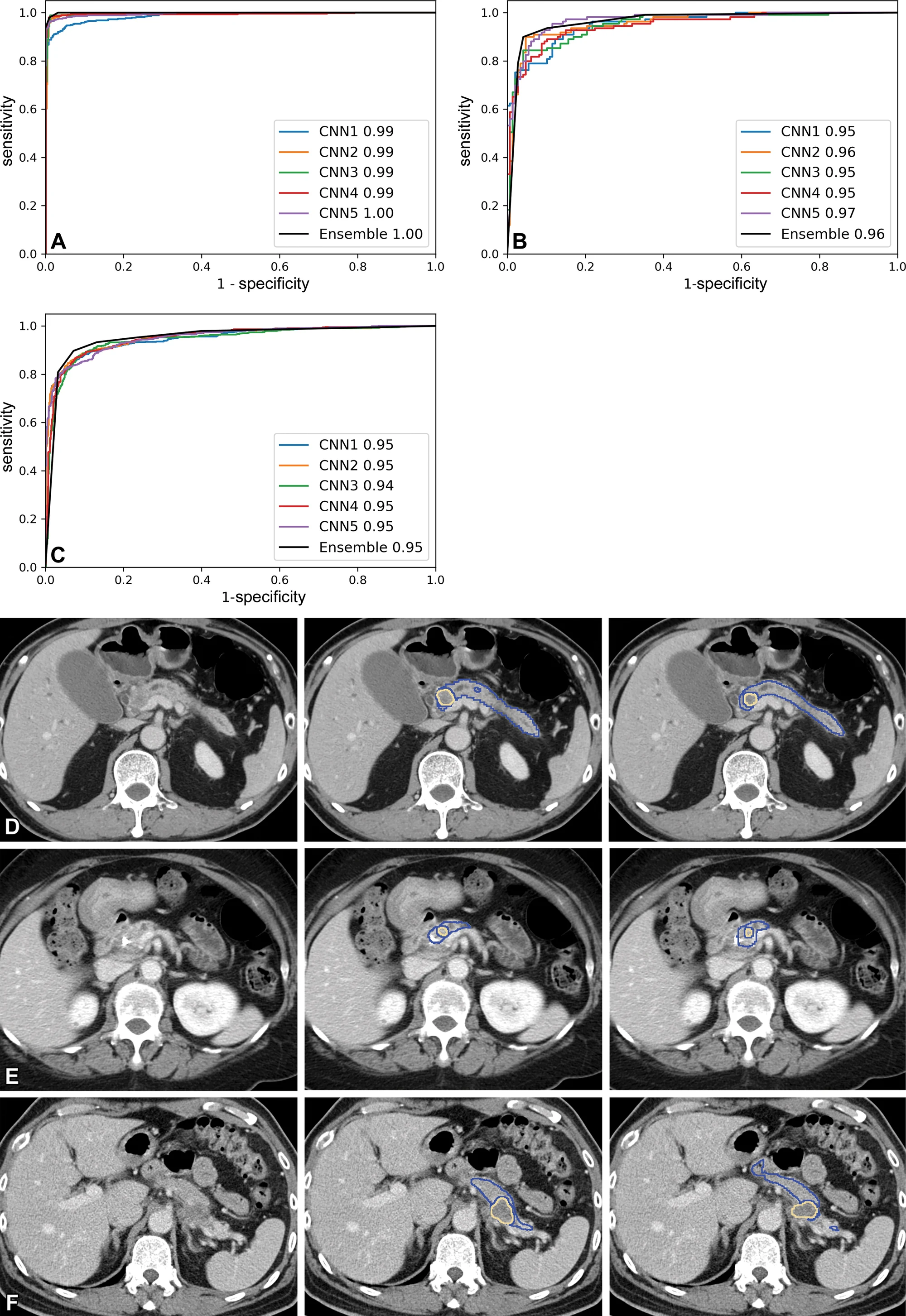 Multi-center validation ROC curve (AUC 0.95) — Radiology 220152 Figure 3